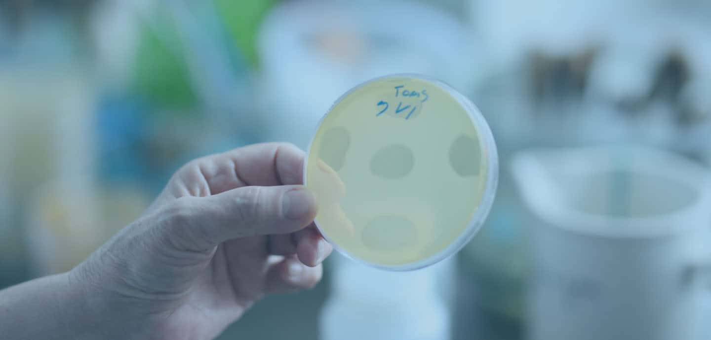 Phage Therapy - The future of medicine